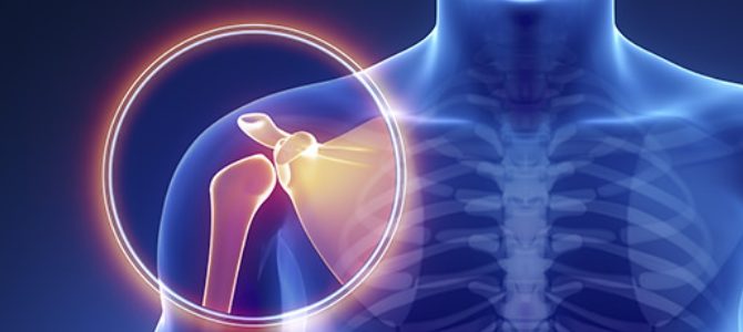 Mal di spalla: cause, sintomi e quando affidarsi alla fisioterapia a Voghera